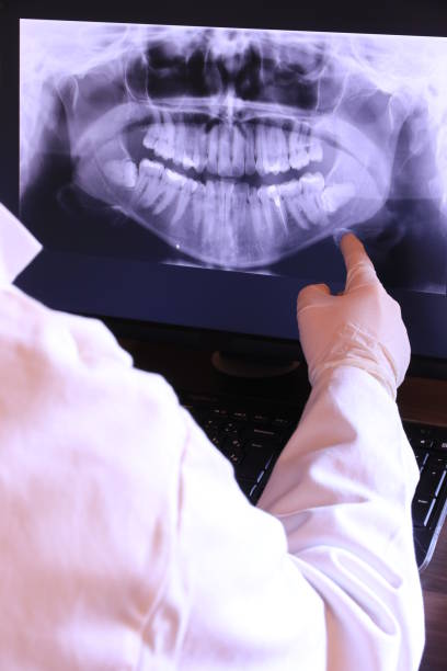 Best Emergency Dentist for Lost Fillings or Crowns in Lake Summerset, IL