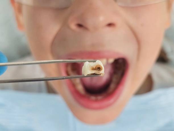 Best Mobile Emergency Dentist in Lake Summerset, IL